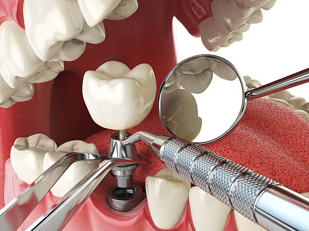 Best After-Hours Emergency Dentist in Menlo Park, CA