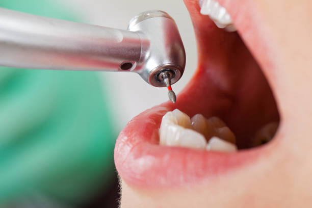 Best Urgent Dental Care in Menlo Park, CA